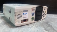 MASIMO RAD-87 PULSE OXIMETER