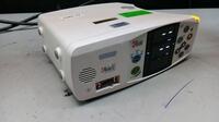 MASIMO RAD-87 PULSE OXIMETER