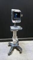 SONOSITE S-FAST PORTABLE ULTRASOUND MACHINE (SERIAL NO. 03D64F) (DOM: 2008-09)