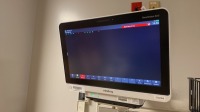 MINDRAY BENEVISION N15 PATIENT MONITOR