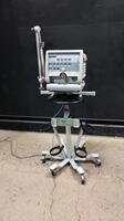 T BIRD VSO2 VENTILATOR